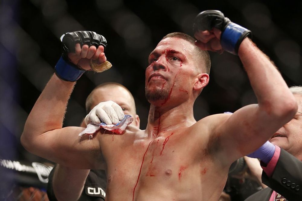 Koliko god da si jak, uvek ima neko jači: Konor MekGregor brutalno isprebijan u ringu! (FOTO) (VIDEO)