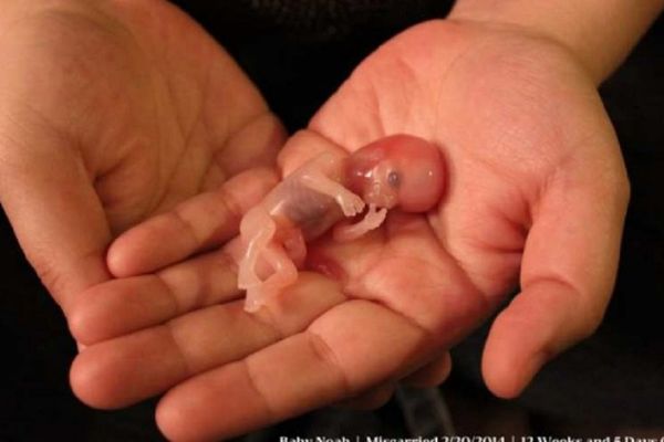 Internet gori: Fotografija koja je pokazala da je skup ćelija u stvari - mali čovek!