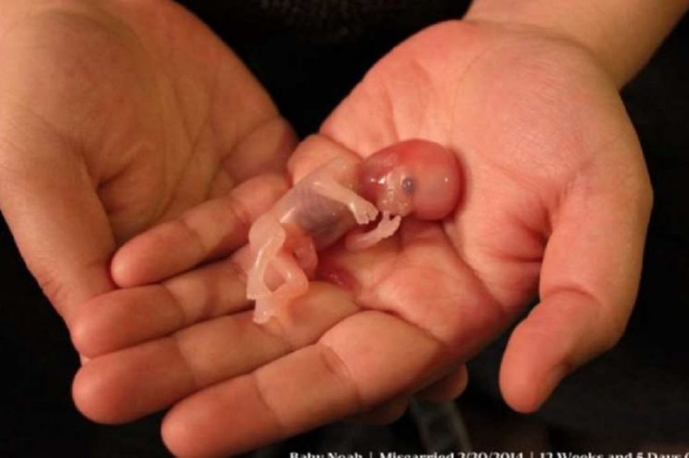 Internet gori: Fotografija koja je pokazala da je skup ćelija u stvari - mali čovek!