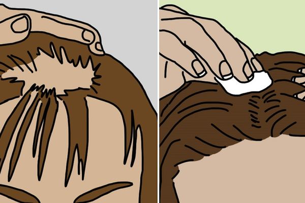 Zbog ovog ženama opada kosa: 7 prirodnih lekova protiv ženske ćelavosti (FOTO)