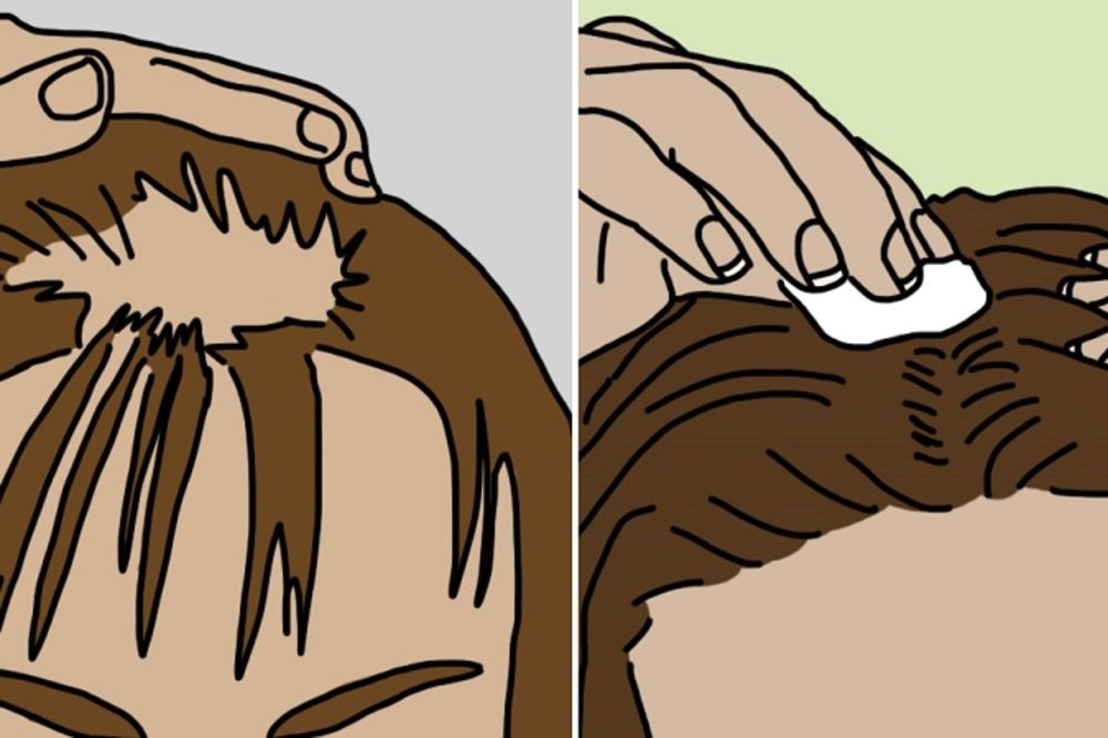 Zbog ovog ženama opada kosa: 7 prirodnih lekova protiv ženske ćelavosti (FOTO)