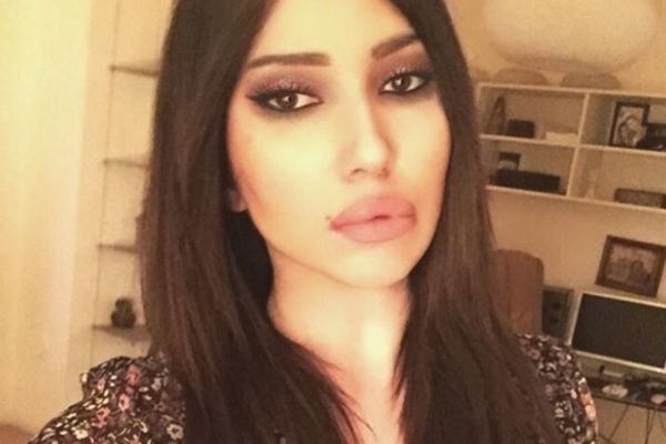 Lepa ćerka Željka Joksimovića poludela što je zovu starleta: Pućim se, pa šta?!