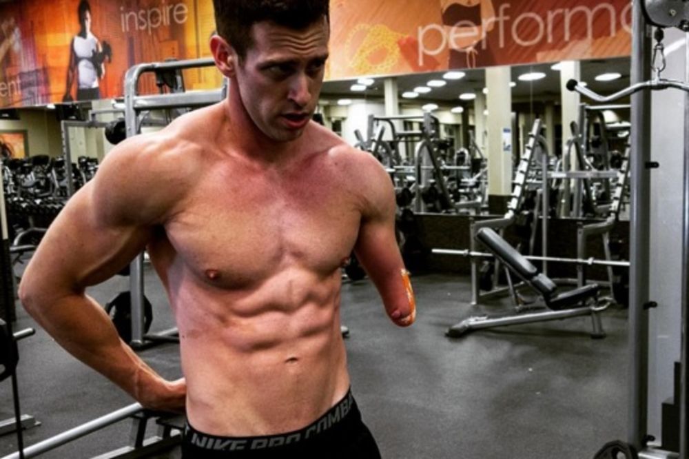 Rodio se bez jedne ruke, ali to ga nije sprečio da bude bodibilder! (FOTO)