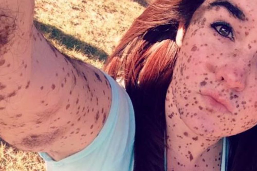 10 tinejdžera kojima je život dao male šanse, ali su oni pobedili opake bolesti (VIDEO)