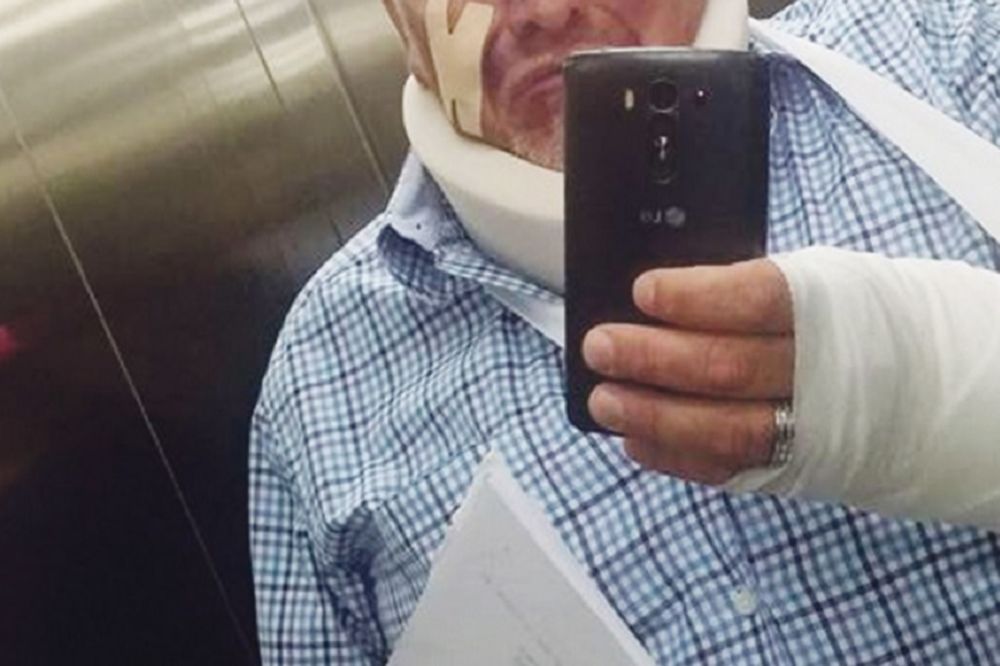 Sav u modricama i zavojima: Pretučen naš poznati voditelj! (FOTO)