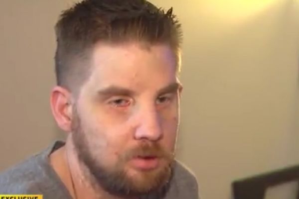 Ćutao je pet godina: Neverovatna poruka čoveka koji nosi tuđe lice (VIDEO)