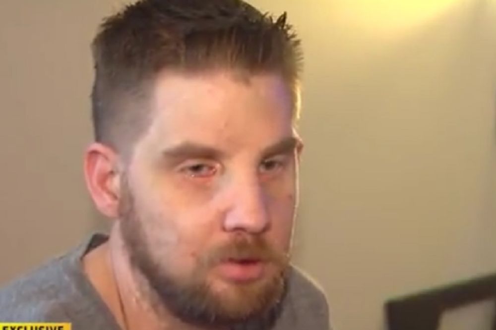 Ćutao je pet godina: Neverovatna poruka čoveka koji nosi tuđe lice (VIDEO)