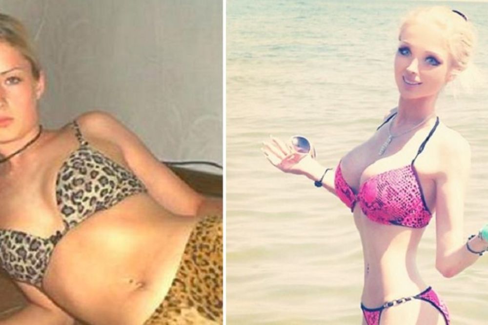 Ona je dokaz da barbika postoji: O transformaciji ove devojke priča ceo svet! (FOTO) (VIDEO)