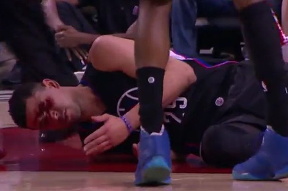 Dobio lakat u glavu i zaradio 11 šavova, ali se vratio na teren i ubacio 21 poen! (VIDEO)