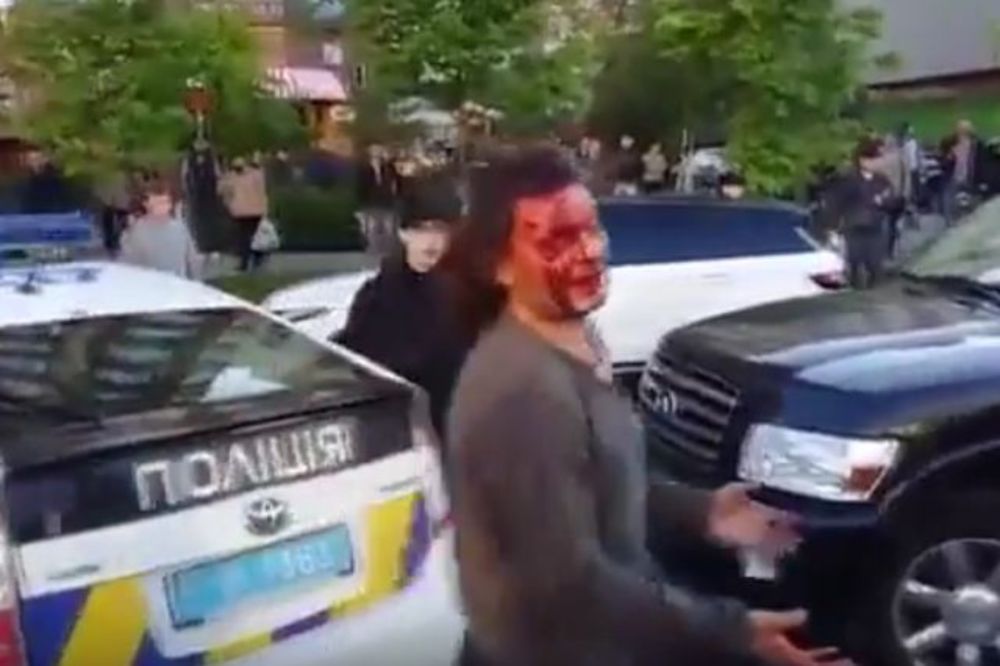 Olimpijski šampion se potukao sa policijom, oni mu razbili glavu! (VIDEO)