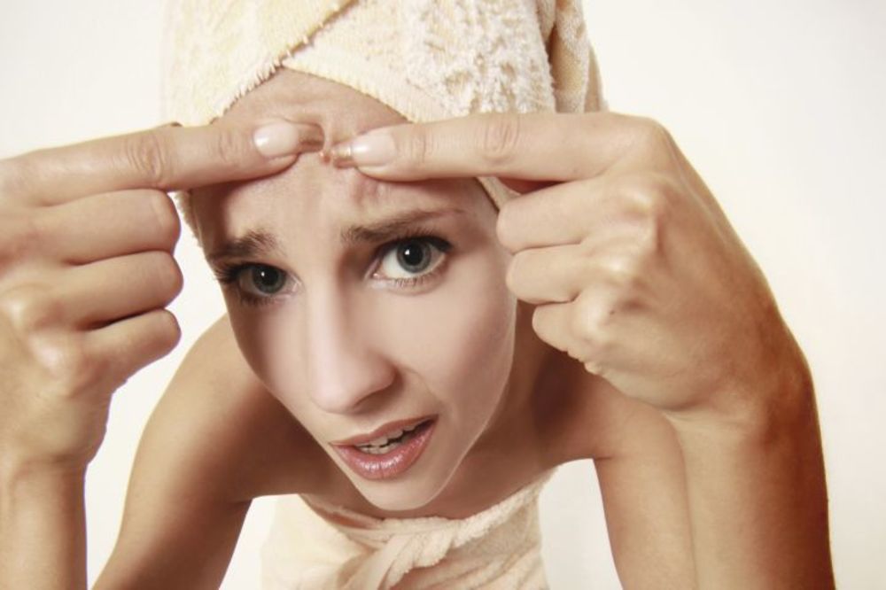 Ako ovim istrljate bubuljicu, ona nestaje preko noći! (VIDEO)