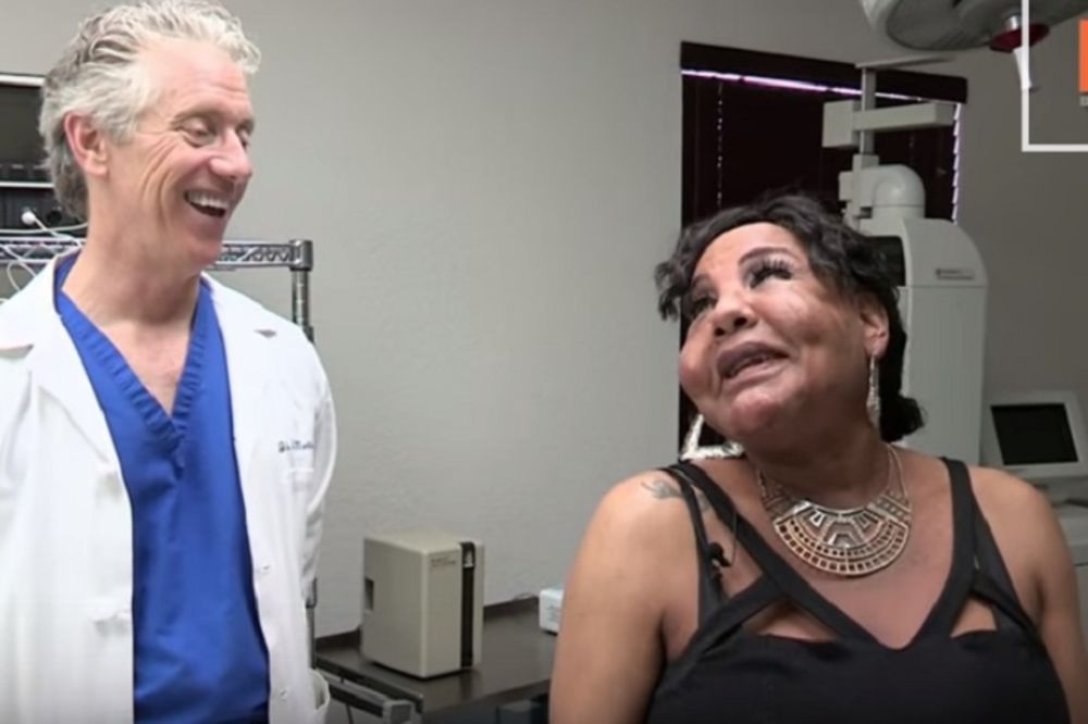 Prolazi kroz pakao: Moli lekare da joj izvade cement iz lica (VIDEO)