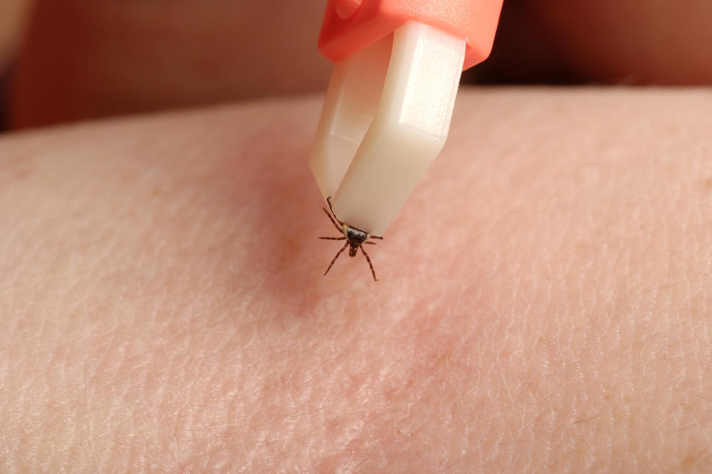 Ovo je jedini pravilan način da izvadite krpelja (FOTO)