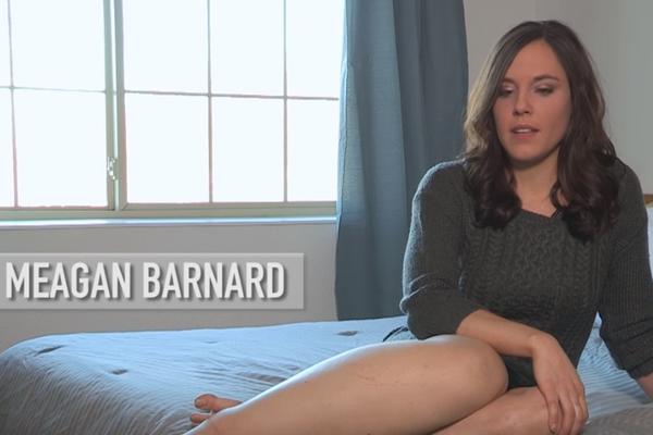 Sigurno ne primećujete: Ona je super model koji krije užasnu tajnu (VIDEO) (FOTO)