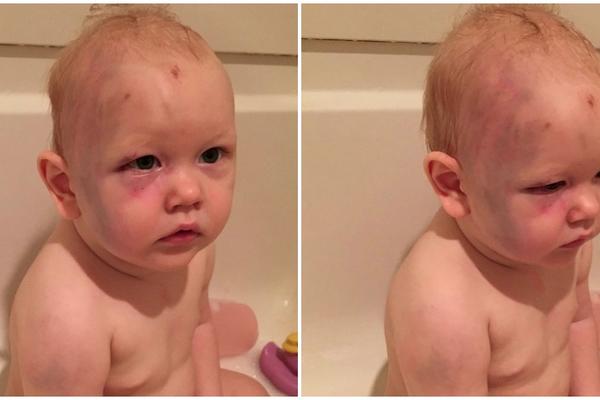 Dadilja im pretukla dete, pa se izvukla na sudu: Obrazloženje sudije je sramotno!