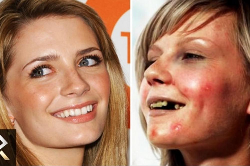 10 zvezda koje je droga uništila: Raspali se za sve pare! (FOTO) (GIF) (VIDEO)