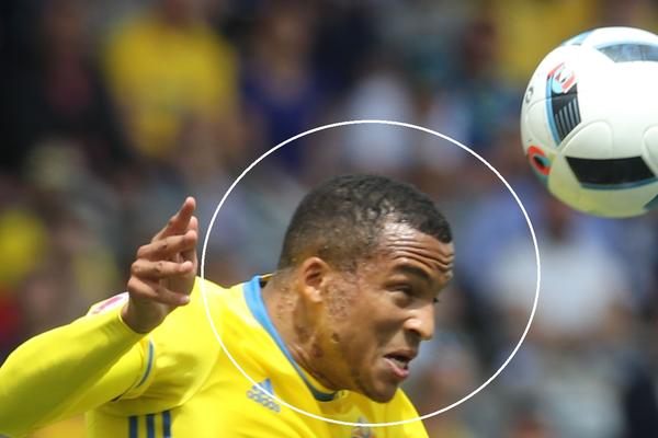 Kakve veze ima Šveđanin sa bonžitom? Lice reprezentativca Švedske je sprženo! (FOTO)