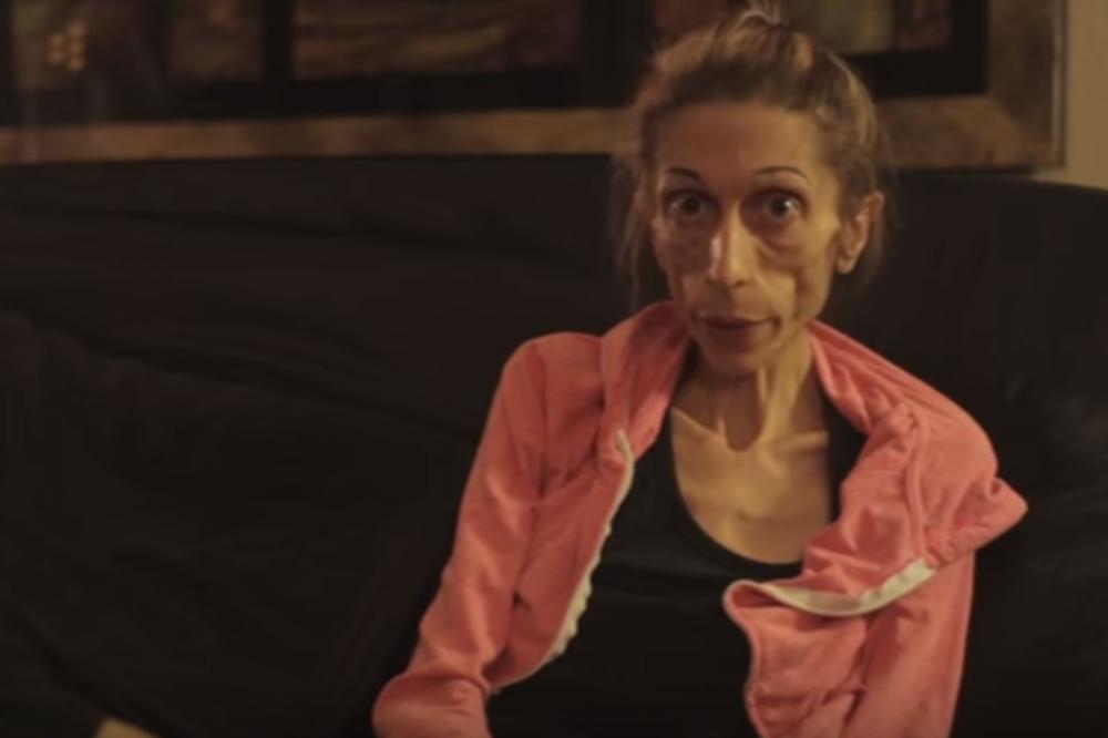 Imala je samo 19 kilograma i život joj je visio o koncu. Šta mislite kako danas izgleda? (VIDEO)