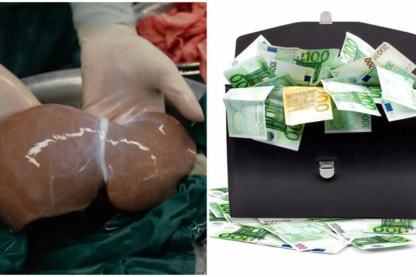 Udario je Rols-Rojs ruskog bogataša i sada prodaje bubreg da bi otplatio štetu! (FOTO) (VIDEO)