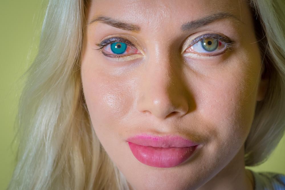 Pukla je 135 hiljada na operacije - i nije joj dosta! Danas izgleda ovako! (FOTO)