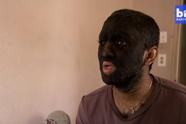 Bez dlake, al' samo na jeziku: Pogledajte najveće čupavce na svetu! (VIDEO)