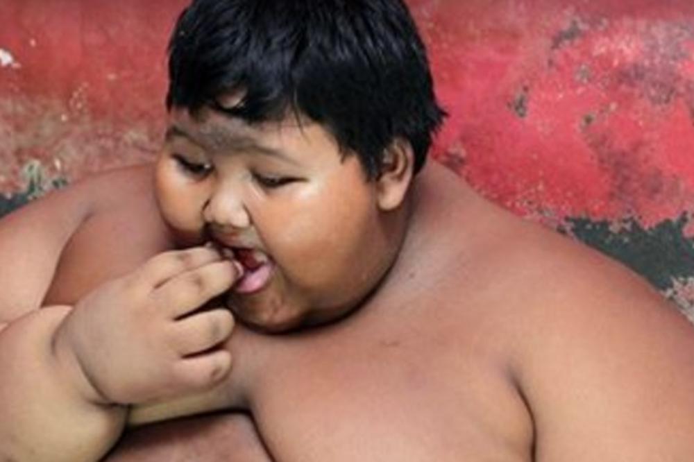 Preti mu smrtonosna dijeta: Evo kako izgleda najdeblji dečak na svetu! (FOTO)