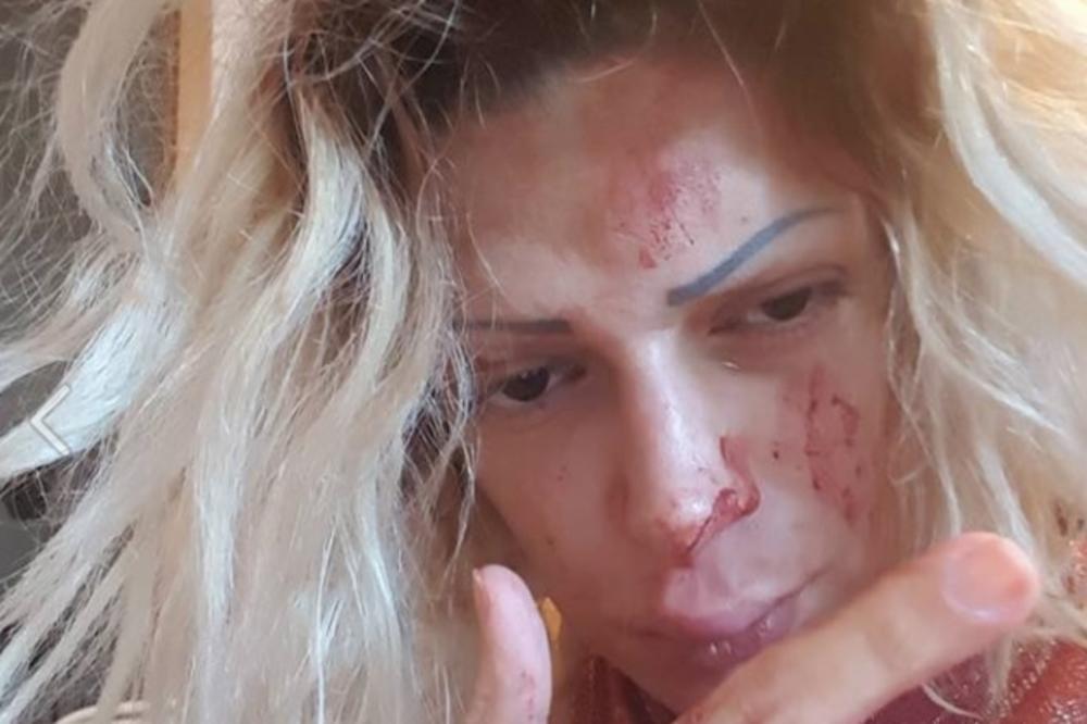 Pretučena srpska pevačica poludela: Iako sam muslimanka, najveća sam Srpkinja!