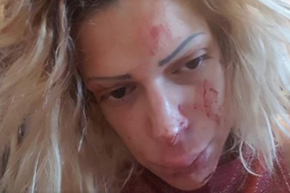 Dosta je patetike! Posle brutalnih batina, Dunja Ilić donela neverovatnu odluku! (FOTO)