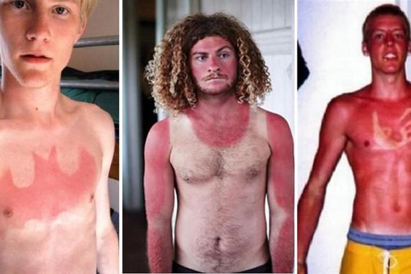 Kolika budala moraš da budeš da se ispečeš ovako? Ovim ljudima je to uspelo! (FOTO)