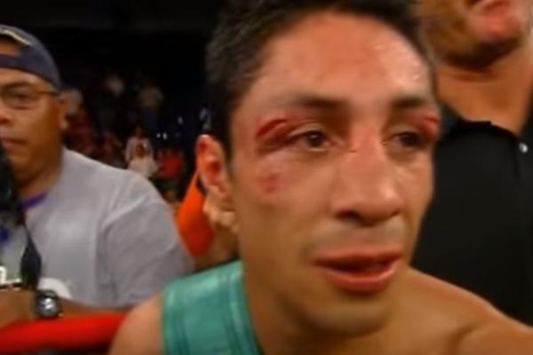 Bokser ostao bez oka: Zbog prevelikog oštećenja mora na operaciju! (UZNEMIRUJUĆI FOTO)