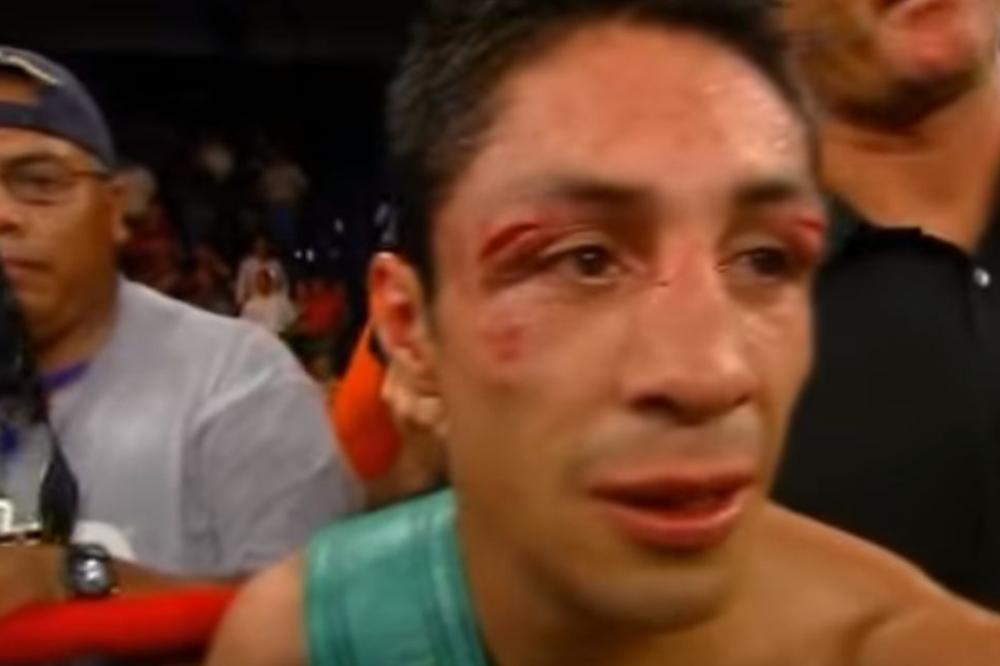 Bokser ostao bez oka: Zbog prevelikog oštećenja mora na operaciju! (UZNEMIRUJUĆI FOTO)