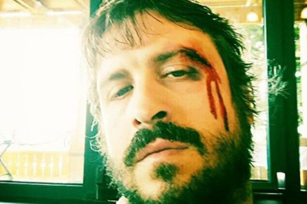 Pukla mu arkada: Banetu Trifunoviću razbili glavu u Crnoj Gori (FOTO)