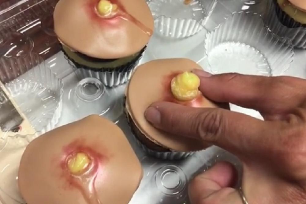 Da li ste spremni da iscedite bubuljicu i progutate je? Odvratniji kolač od ovog sigurno niste videli! (FOTO) (VIDEO)