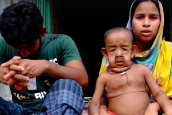 Ima samo 4 godine, a izgleda kao deda od 80 leta! (FOTO) (VIDEO)