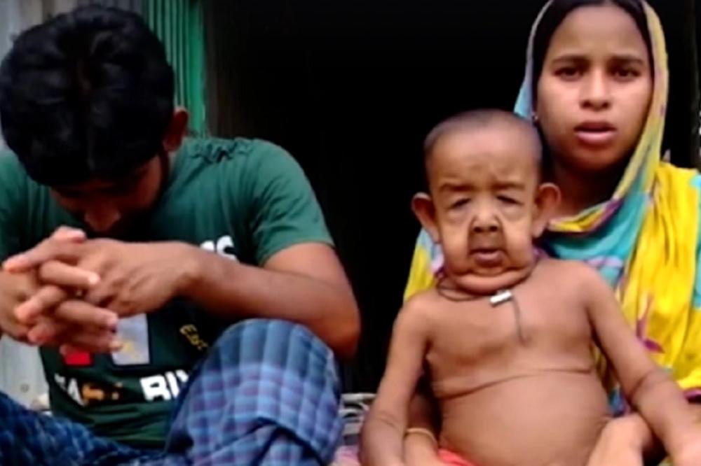 Ima samo 4 godine, a izgleda kao deda od 80 leta! (FOTO) (VIDEO)