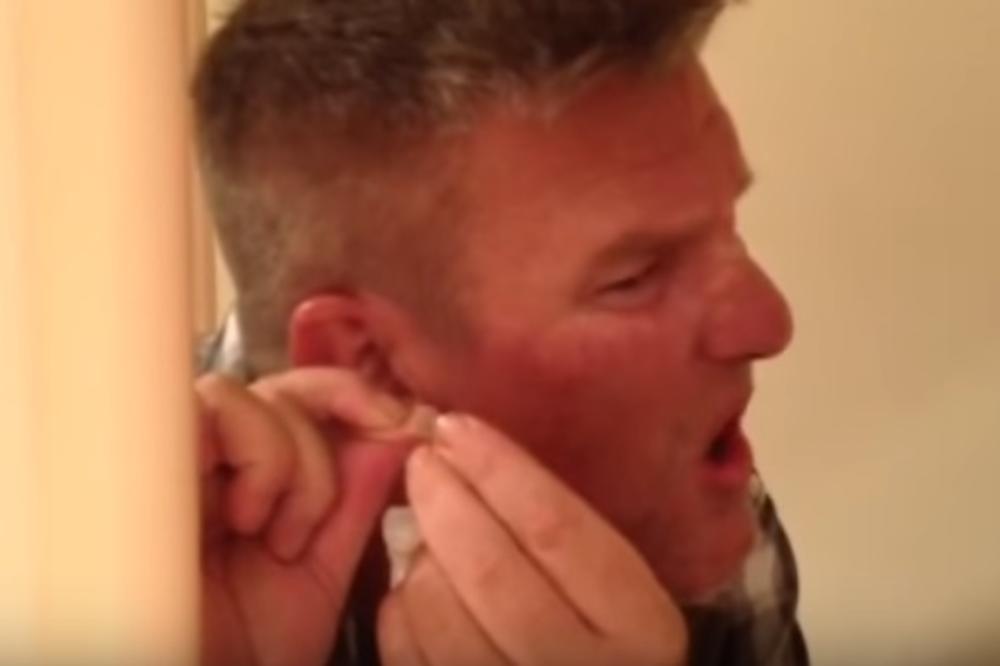 Grozno, fuj, bez reči, bljak! Ne možete a da ne pogledate kako lik cedi ogromnu bubuljicu na uvetu (VIDEO)