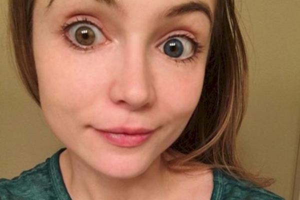 Potrošila je preko 10.000 dolara na plastične opracije samo da bi izgledala kao Diznijeva princeza! Provalite je sad! (FOTO)