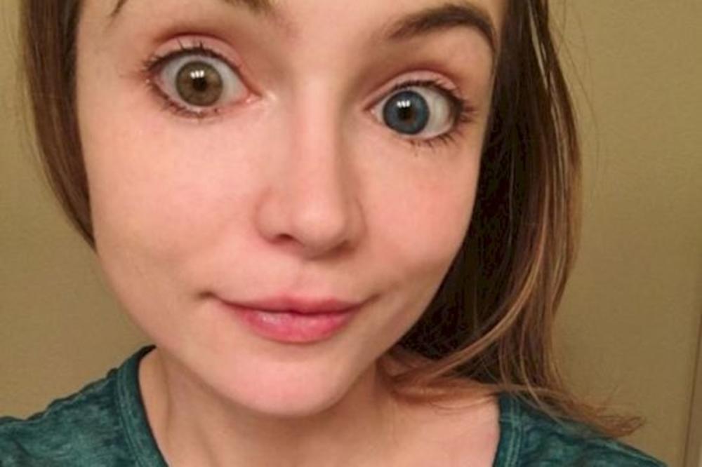 Potrošila je preko 10.000 dolara na plastične opracije samo da bi izgledala kao Diznijeva princeza! Provalite je sad! (FOTO)