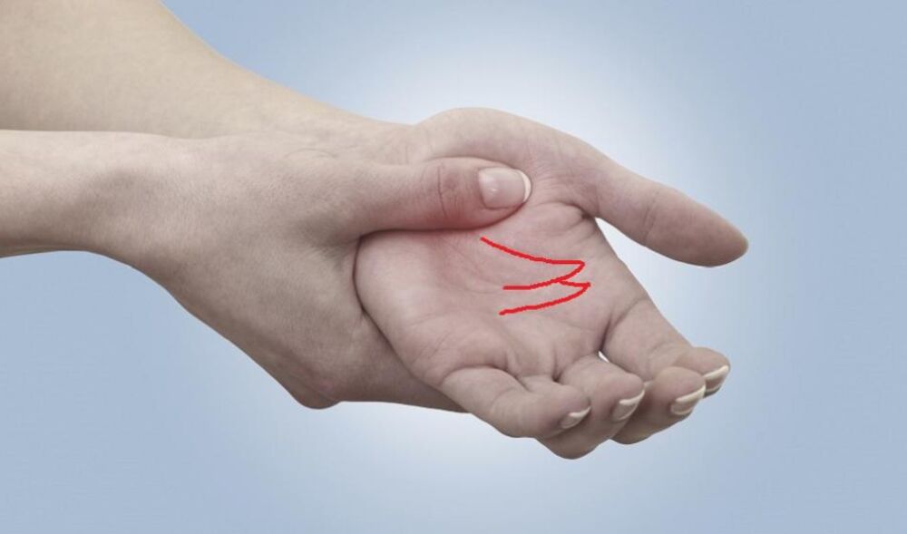 Sudbonosni znak na dlanu