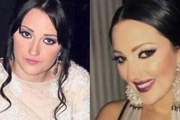 Au ženo zahvali se plastičaru: Kada budete videli ove rane radove Prijovićke sve će vam biti jasno!