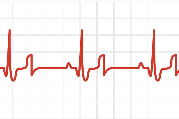 POZNATI HIRURG izazvao HAOS: Sve što znate o bolesti srca je LAŽ, SAMO trebate da uradite ovo!