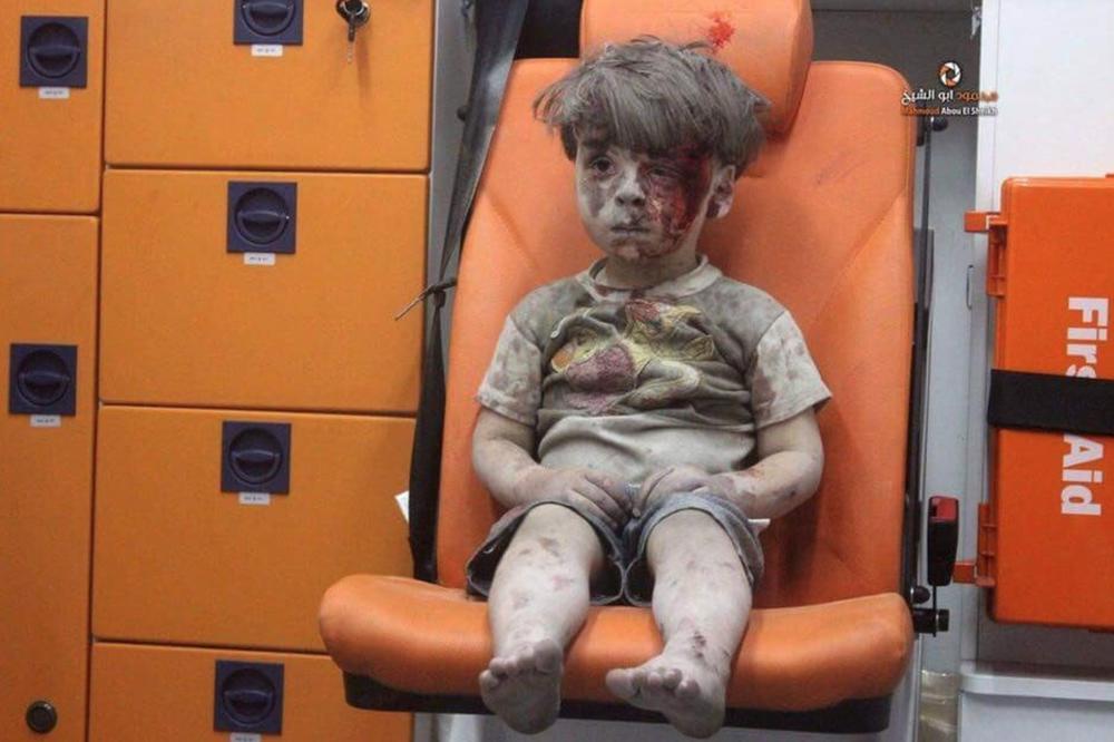 Dečje lice u krvi i prašini: Fotka petogodišnjaka potresla svet! (FOTO) (VIDEO)