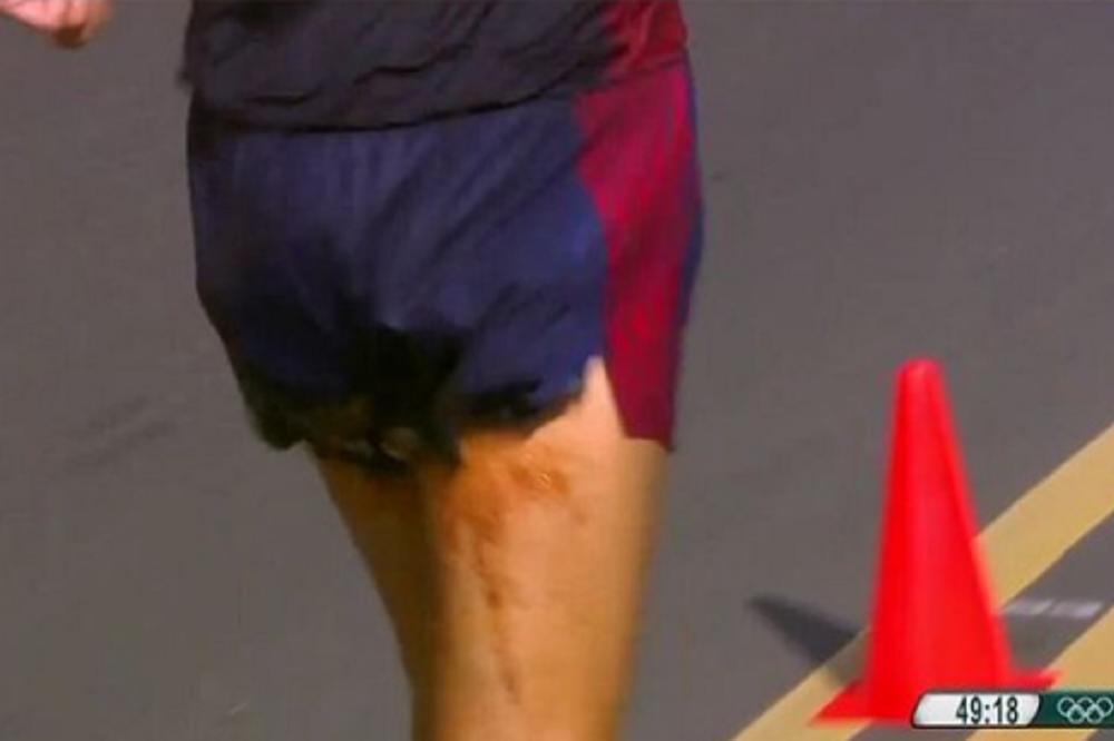 Neviđeno do sad: Takmičar u brzom hodanju se ukakio u gaće usred trke! (VIDEO)
