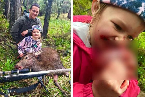 Upucali jelena, pa dao ćerki da jede srce životinje da bi se hvalio na FB! (FOTO)
