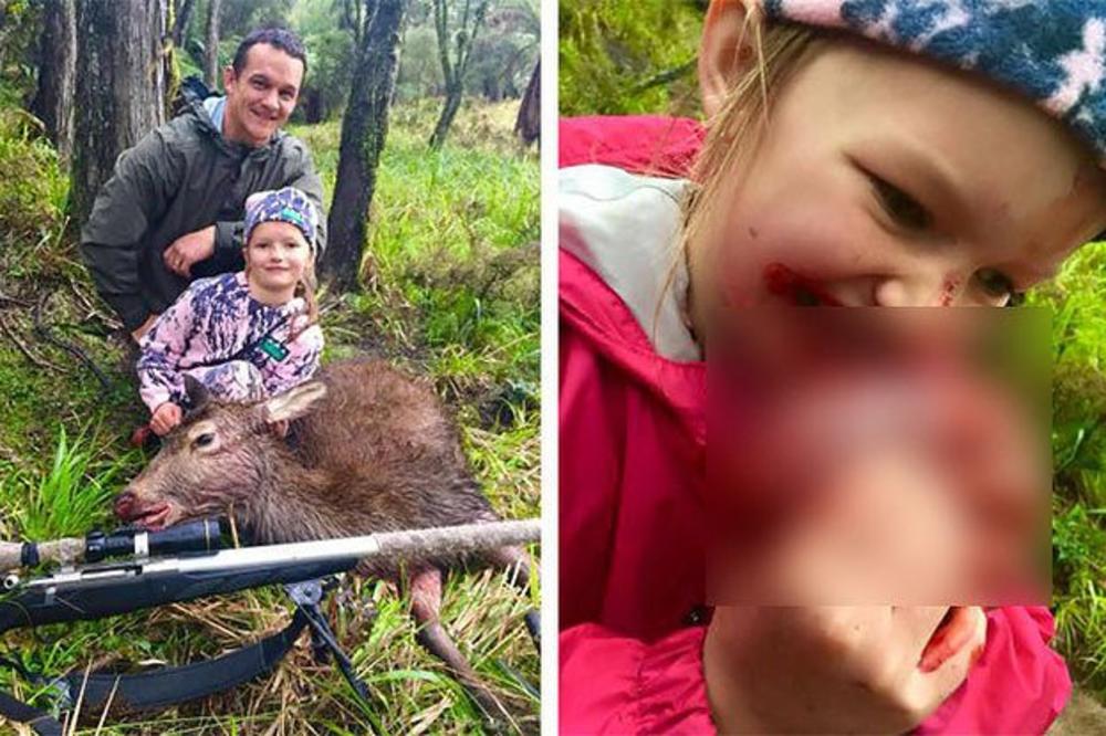 Upucali jelena, pa dao ćerki da jede srce životinje da bi se hvalio na FB! (FOTO)