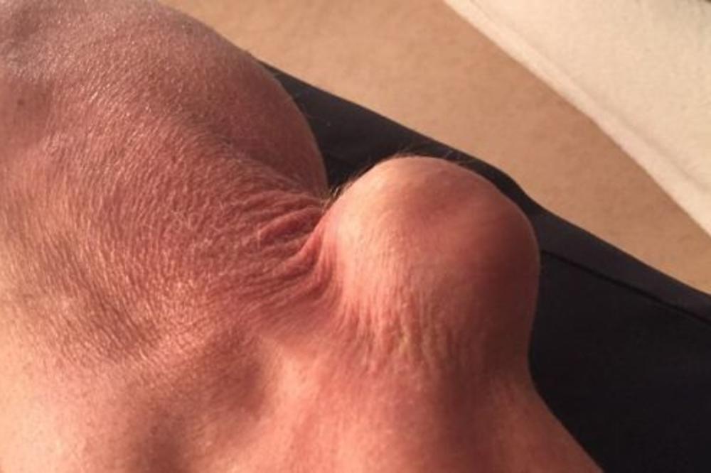 Da li znate koji je ovo deo tela? (UZNEMIRUJUĆI FOTO)