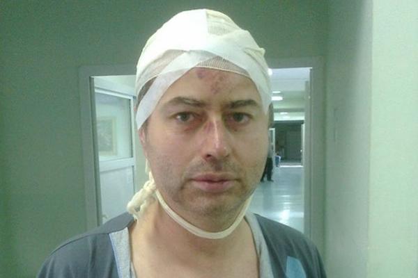 Pretučeni profesor: Otvorio sam vrata i dobio pesnicu u glavu!