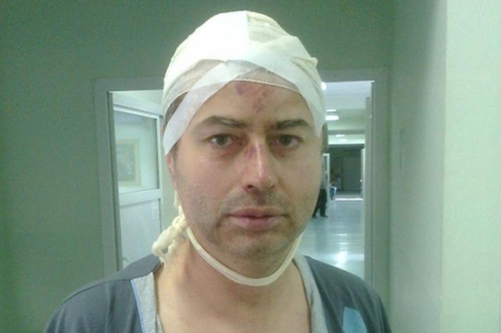 Pretučeni profesor: Otvorio sam vrata i dobio pesnicu u glavu!