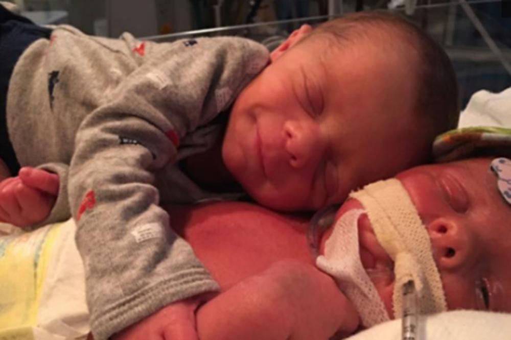 Živote, ima li te? Beba grli svog bolesnog brata blizanca! (FOTO)