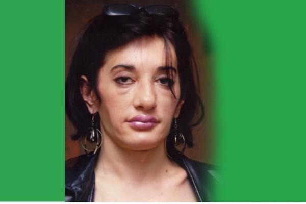 Gordani su svi umrli, živi potpuno sama i bori se kao lavica sa opakom bolešću od 12. godine života!